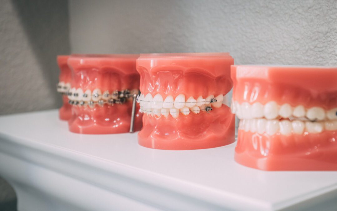 Beyond Metal Mouth: Exploring Modern Orthodontic Options