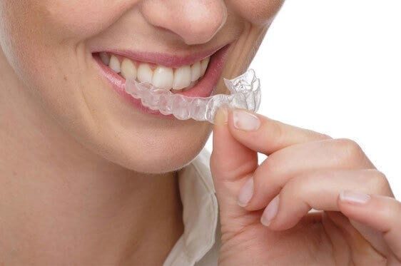 7 WAYS TO CLEAN YOUR INVISALIGN TRAYS