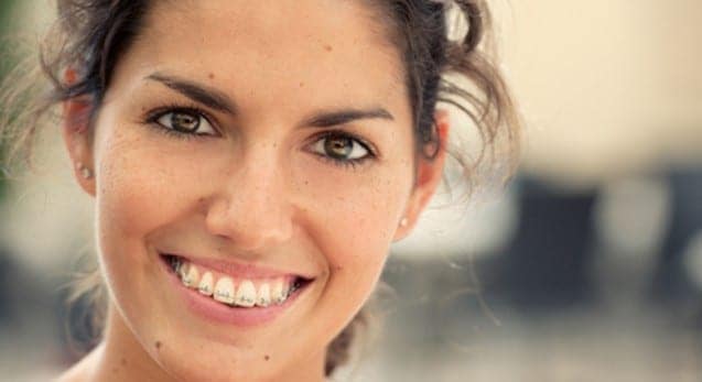 Adult smiling woman with metal braces